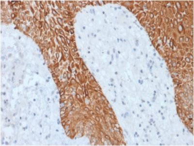 Formalin-fixed, paraffin-embedded human Skin stained with Multi-Cytokeratin Recombinant Rabbit Monoclonal Antibody (KRT/1877R).