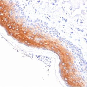 Formalin-fixed, paraffin-embedded human Skin stained with Cytokeratin 1 Mouse Monoclonal Antibody (KRT1/1840).