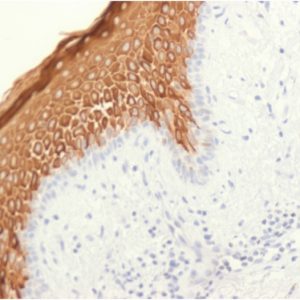 Formalin-fixed, paraffin-embedded human skin stained with Cytokeratin 10 Rabbit Recombinant Monoclonal Antibody (KRT10/1948R).