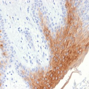 Formalin-fixed, paraffin-embedded human Skin stained with Cytokeratin 10 Rabbit Recombinant Monoclonal Antibody (KRT10/1990R).