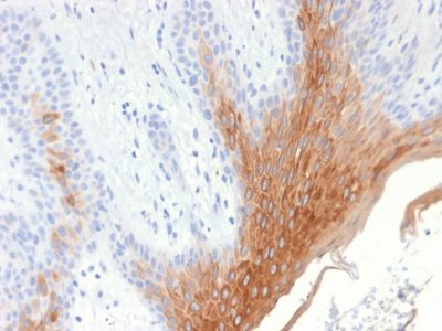 Formalin-fixed, paraffin-embedded human Skin stained with Cytokeratin 10 Rabbit Recombinant Monoclonal Antibody (KRT10/1990R).