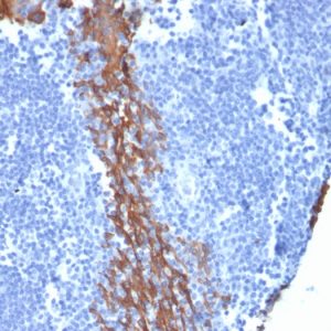 Formalin-fixed, paraffin-embedded human Tonsil stained with Cytokeratin 13 Mouse Monoclonal Antibody (KRT13/2213).