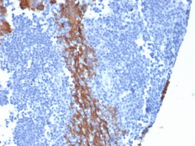Formalin-fixed, paraffin-embedded human Tonsil stained with Cytokeratin 13 Mouse Monoclonal Antibody (KRT13/2213).