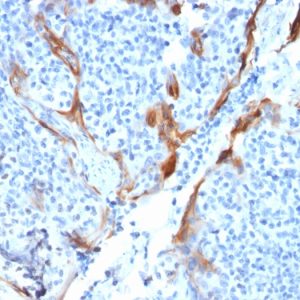 Formalin-fixed, paraffin-embedded human Tonsil stained with Cytokeratin 16 Mouse Recombinant Monoclonal Antibody (KRT16/1714).