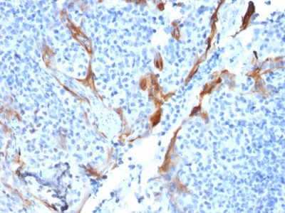 Formalin-fixed, paraffin-embedded human Tonsil stained with Cytokeratin 16 Mouse Recombinant Monoclonal Antibody (KRT16/1714).