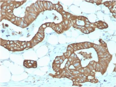 Formalin-fixed, paraffin-embedded human Colon stained with Cytokeratin 19 Rabbit Recombinant Monoclonal Antibody (KRT19/1959R).