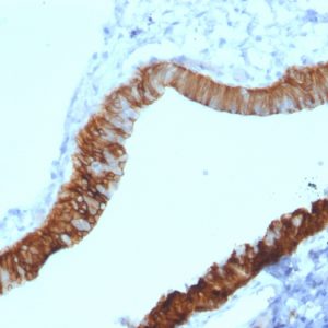Formalin-fixed, paraffin-embedded human Ovary stained with Cytokeratin 3 Mouse Monoclonal Antibody (KRT3/2130).