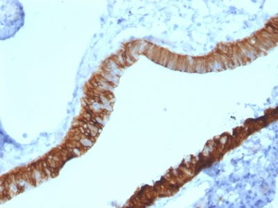 Formalin-fixed, paraffin-embedded human Ovary stained with Cytokeratin 3 Mouse Monoclonal Antibody (KRT3/2130).