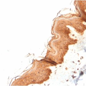 Formalin-fixed, paraffin-embedded human Skin stained with Cytokeratin 4 Mouse Monoclonal Antibody (KRT4/2804).