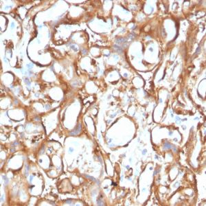 Formalin-fixed, paraffin-embedded human Placenta stained with Ezrin Mouse Monoclonal Antibody (CPTC-Ezrin-1).