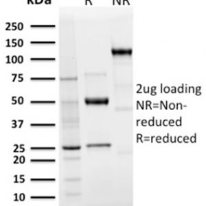 SDS-PAGE Analysis Purified Langerin Recombinant Rabbit Monoclonal Antibody (LGRN/3136R). Confirmation of Integrity and Purity of Antibody.