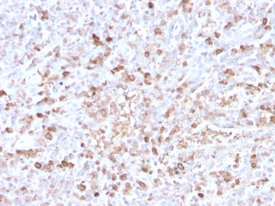 Formalin-fixed, paraffin-embedded human spleen stained with Lambda Light Chain Recombinant Rabbit Monoclonal Antibody (LLC/3778R).