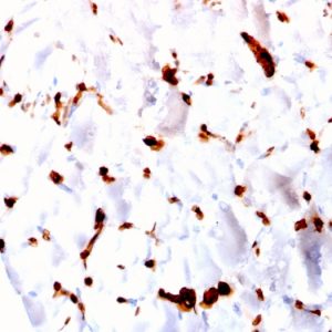 Formalin-fixed, paraffin-embedded human Skeletal Muscle stained with FABP5 Mouse Monoclonal Antibody (CPTC-FABP5-3).