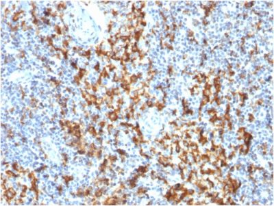 Formalin-fixed, paraffin-embedded human Lymph Node stained with CD163 Mouse Monoclonal Antibody (M130/1210).