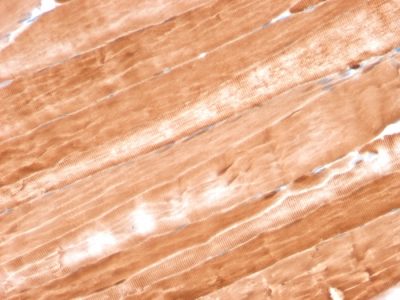 Formalin-fixed, paraffin-embedded Rat Skeletal Muscle stained with Myoglobin Mouse Monoclonal Antibody (MB/2105).