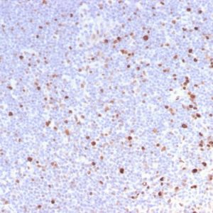 Formalin-fixed, paraffin-embedded human Lymph Node stained with MCM7 Rabbit Recombinant Monoclonal Antibody (MCM7/2832R).