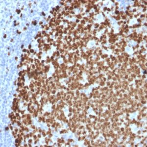 Formalin-fixed, paraffin-embedded human Tonsil stained with Ki67 Mouse Monoclonal Antibody (MKI67/2461).