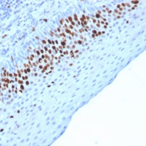 Formalin-fixed, paraffin-embedded human Skin stained with Ki67 Mouse Monoclonal Antibody (MKI67/2463).