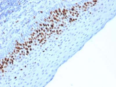 Formalin-fixed, paraffin-embedded human Skin stained with Ki67 Mouse Monoclonal Antibody (MKI67/2463).