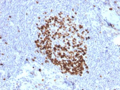 Formalin-fixed, paraffin-embedded human Tonsil stained with Ki67 Mouse Monoclonal Antibody (MKI67/2466).