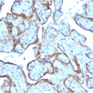 Formalin-fixed, paraffin-embedded human Placenta stained with MMP3 Mouse Monoclonal Antibody (MMP3/2806).
