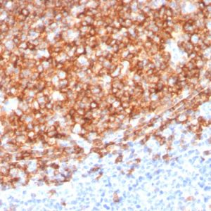 Formalin-fixed, paraffin-embedded human Tonsil stained with CD20 Mouse Monoclonal Antibody (MS4A1/3410).
