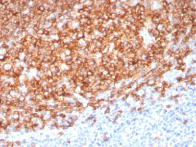 Formalin-fixed, paraffin-embedded human Tonsil stained with CD20 Mouse Monoclonal Antibody (MS4A1/3410).