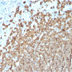 Formalin-fixed, paraffin-embedded human Tonsil stained with CD20 Mouse Monoclonal Antibody (MS4A1/3411).