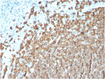Formalin-fixed, paraffin-embedded human Tonsil stained with CD20 Mouse Monoclonal Antibody (MS4A1/3411).