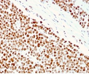 Formalin-fixed, paraffin-embedded human Small Intestine stained with MSH6 Mouse Monoclonal Antibody (MSH6/3086).