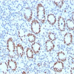 Formalin-fixed, paraffin-embedded human Small Intestine stained with MSH6 Mouse Monoclonal Antibody (MSH6/3089).