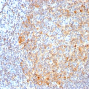 Formalin-fixed, paraffin-embedded human Tonsil stained with MALT1 Recombinant Rabbit Monoclonal Antibody (MT1/3159R).