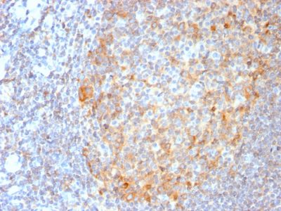 Formalin-fixed, paraffin-embedded human Tonsil stained with MALT1 Recombinant Rabbit Monoclonal Antibody (MT1/3159R).