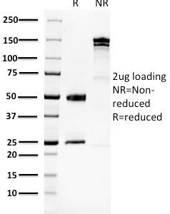 SDS-PAGE Analysis Purified GPI Mouse Monoclonal Antibody (CPTC-GPI-1). Confirmation of Purity and Integrity of Antibody.