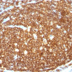 Formalin-fixed, paraffin-embedded human Tonsil stained with CD45RB Rabbit Polyclonal Antibody.