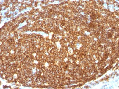 Formalin-fixed, paraffin-embedded human Tonsil stained with CD45RB Rabbit Polyclonal Antibody.