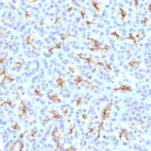 Formalin-fixed, paraffin-embedded human Pancreas stained with CFTR Rabbit Polyclonal Antibody.