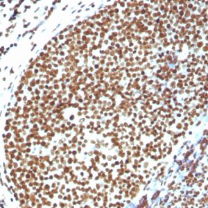 Formalin-fixed, paraffin-embedded human Tonsil stained with Histone H1 Rabbit Polyclonal Antibody.