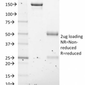 SDS-PAGE Analysis Purified NKX2.8 Mouse Monoclonal Antibody (NKX28/2547). Confirmation of Purity and Integrity of Antibody.
