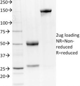 SDS-PAGE Analysis Purified NKX2.8 Mouse Monoclonal Antibody (NKX28/2548). Confirmation of Integrity and Purity of Antibody.