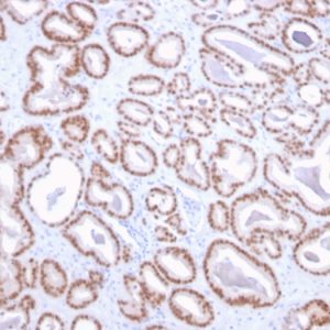 Formalin-fixed, paraffin-embedded human prostate stained with NKX3.1-Monospecific Mouse Monoclonal Antibody (NKX3.1/2836).