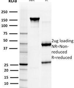 SDS-PAGE Analysis Purified GST Mu3 Mouse Monoclonal Antibody (CPTC- GSTMu3-1). Confirmation of Purity and Integrity of Antibody.