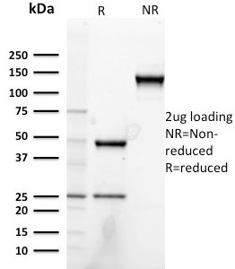 SDS-PAGE Analysis Purified Heregulin-1 Mouse Monoclonal Antibody (NRG1/2752). Confirmation of Purity and Integrity of Antibody.