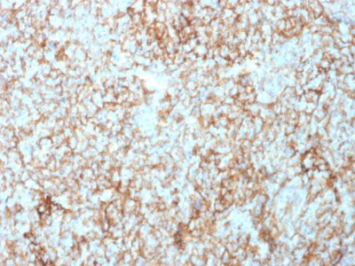 Formalin-fixed, paraffin-embedded human Tonsil stained with CD73 Mouse Monoclonal Antibody (NT5E/2503).