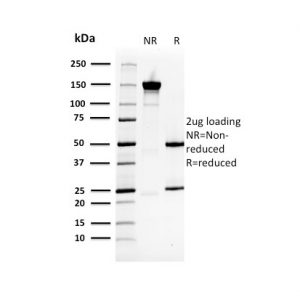 SDS-PAGE Analysis Purified HSP27 Mouse Monoclonal Antibody (CPTC-HSPB1-2). Confirmation of Purity and Integrity of Antibody