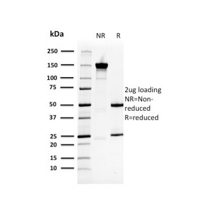 SDS-PAGE Analysis Purified HSP27 Mouse Monoclonal Antibody (CPTC-HSPB1-2). Confirmation of Purity and Integrity of Antibody