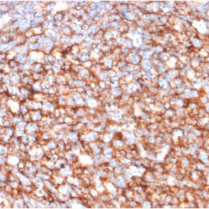 Formalin-fixed, paraffin-embedded human Tonsil stained with CD73 Mouse Monoclonal Antibody (NT5E/2646).
