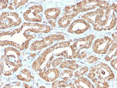 Formalin-fixed, paraffin-embedded human Prostate stained with ODC1 Rabbit Recombinant Monoclonal Antibody (ODC1/2878R).