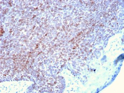 Formalin-fixed, paraffin-embedded human Skin stained with p73 Mouse Monoclonal Antibody (P73/2531).