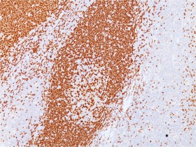 Formalin-fixed, paraffin-embedded human Tonsil stained with PAX5 Mouse Monoclonal Antibody (PAX5/3735).